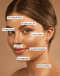 Botox