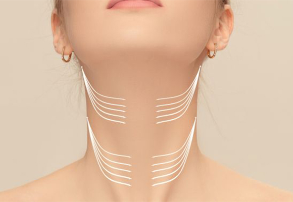 Botox – Edged Vertical Neck Line (Platysmal Bands)