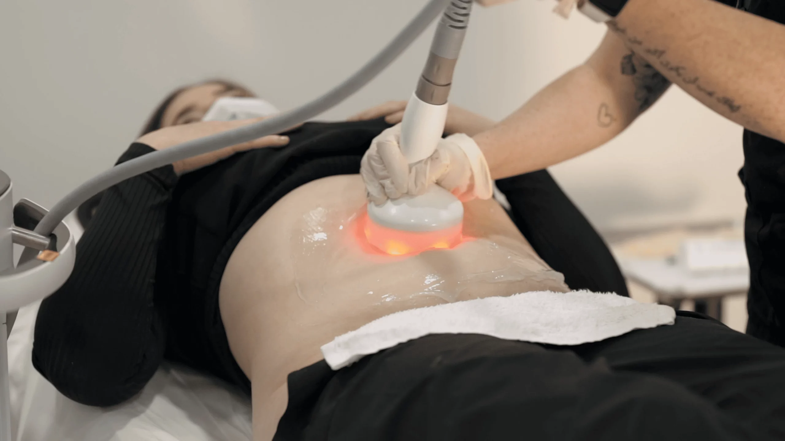 RF Cavitation for Belly Fat