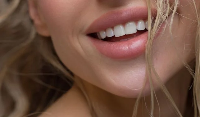 Dermal Filler – Smile & Laugh Lines (NASOLABILAL FOLDS)