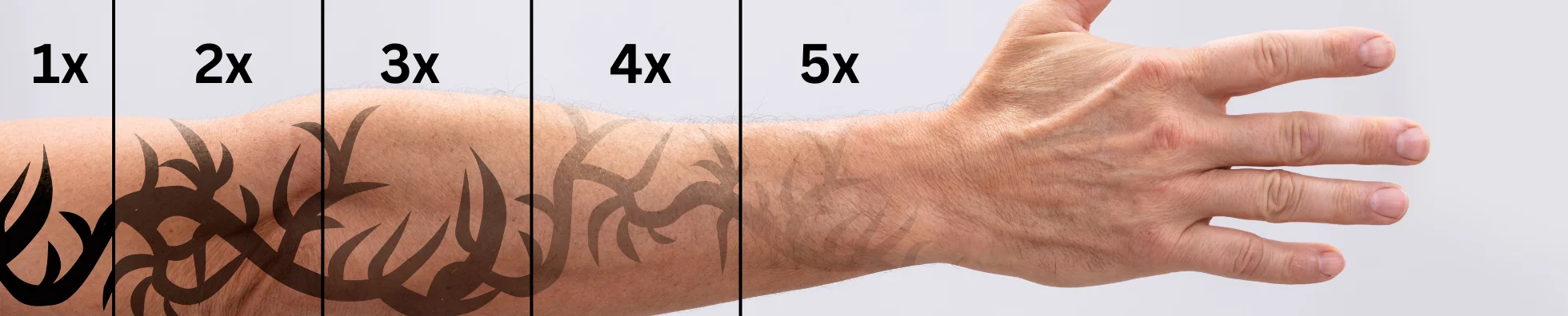 Tattoo removal 2 by 2 inches