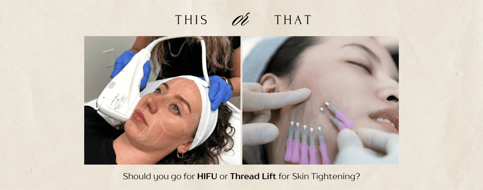 Exploring HIFU and Thread Lift Non-Invasive and Minimally Invasive Options for Facial Rejuvenation