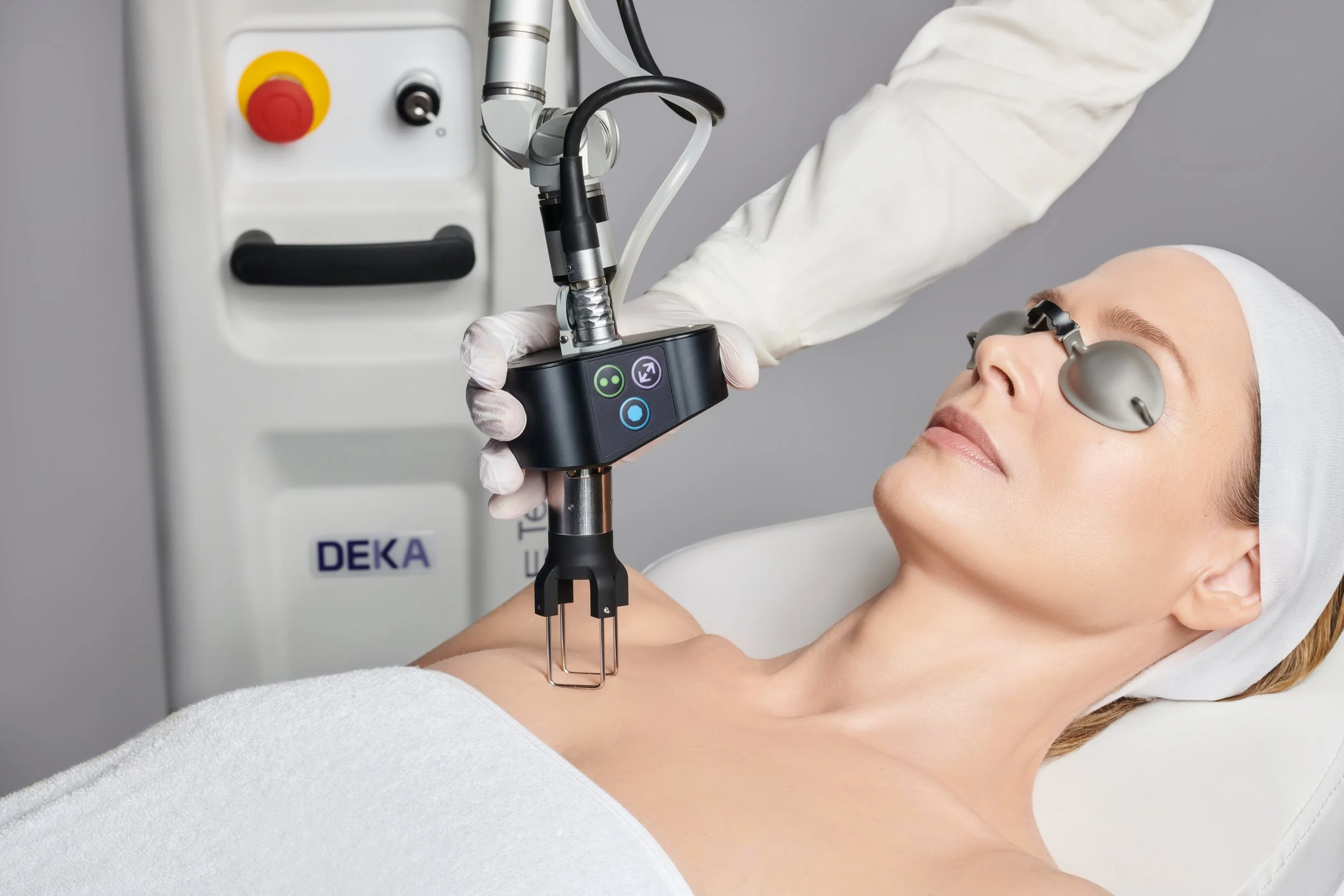 CoolPeel Laser Treatment – Decolletage