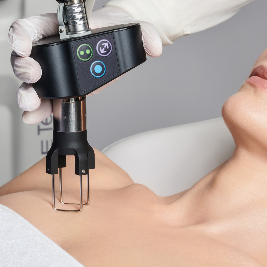 CoolPeel Laser Treatment – Neck & Decolletage