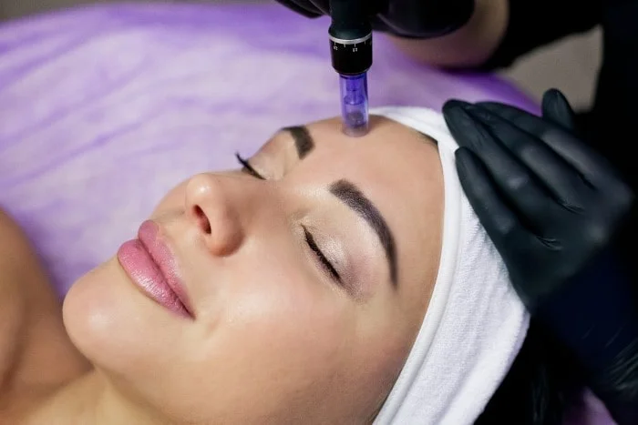 Microneedling Face & Neck
