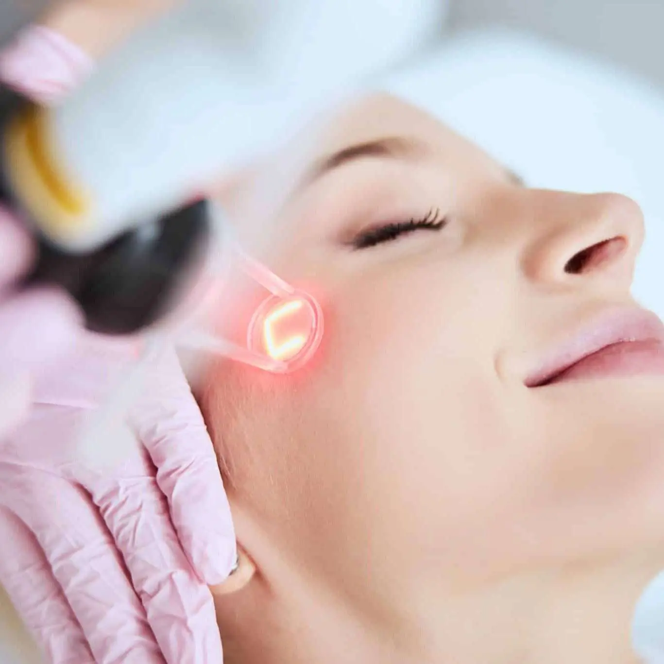 Laser Skin Rejuvenation – Face