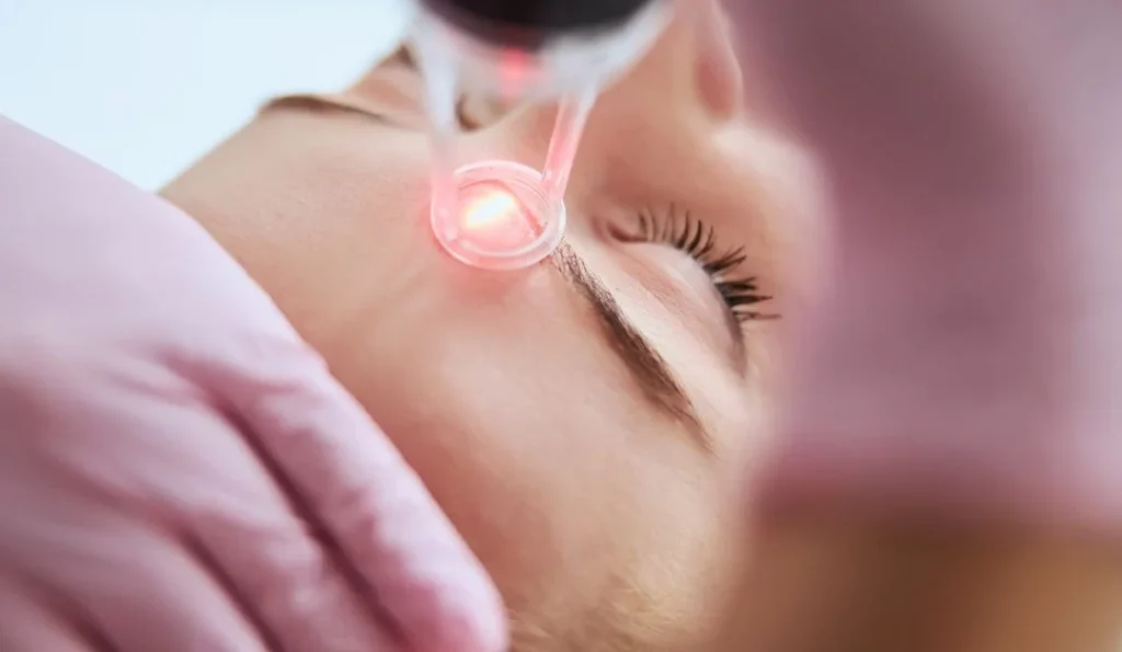 Laser Skin Rejuvenation – Face