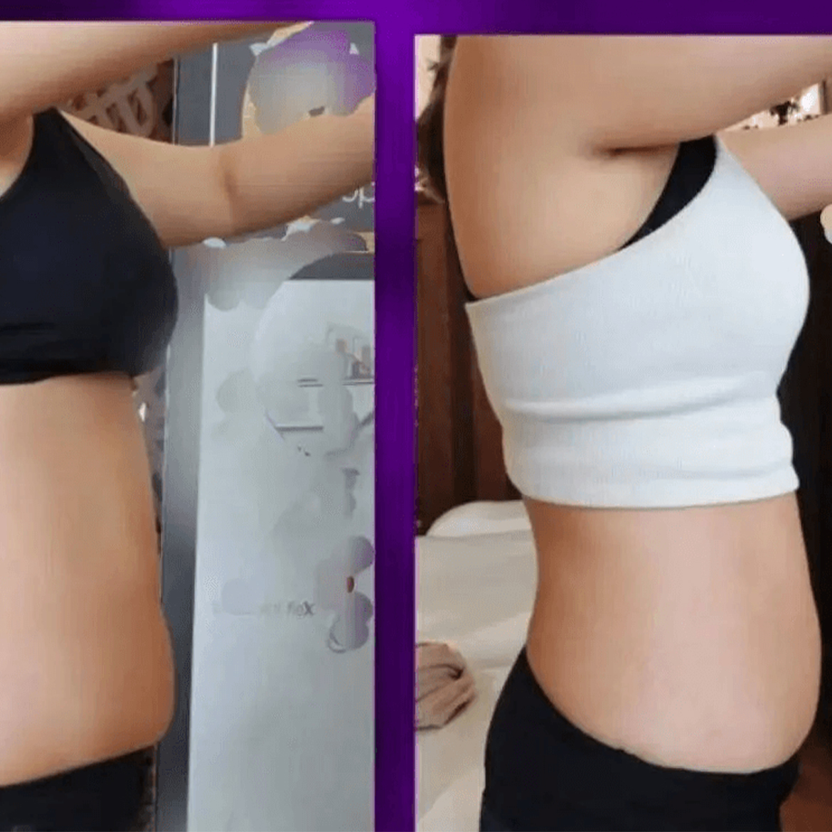 Body Contouring Toronto