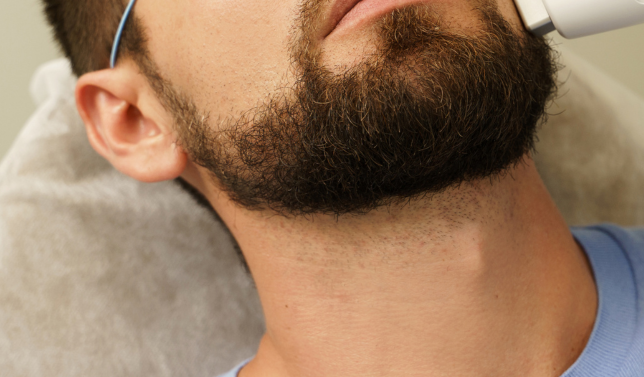 Darwin Beard Line Laser Hair Removal