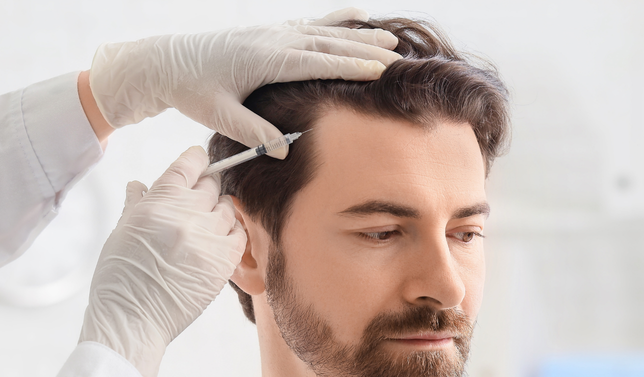 Microneedling + Exosomes/PDRN (Hair)